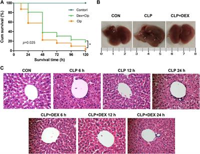 Dexmedetomidine Protects Against Septic Liver Injury by Enhancing Autophagy Through Activation of the AMPK/SIRT1 Signaling Pathway